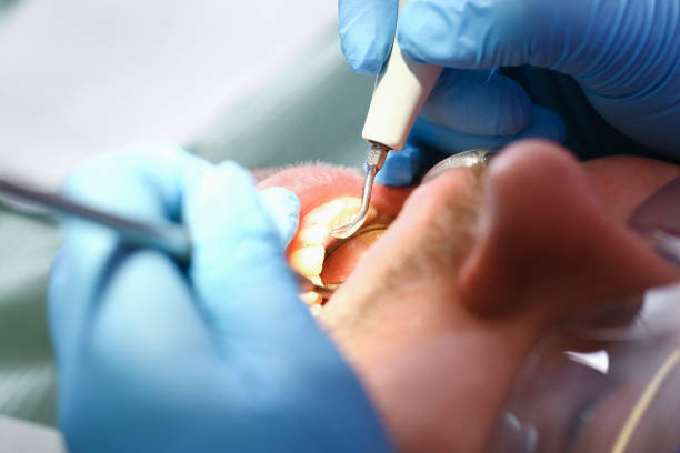 Best Emergency Treatment for Jaw Pain or Injury in Republic, WA