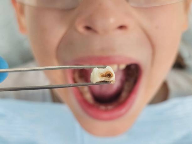 Best Emergency Dental Care for Sports Injuries in Republic, WA